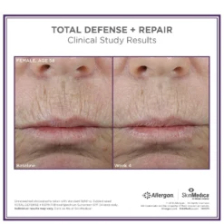 SkinMedica Total Defense + Repair SPF 34 (2.3 Oz.) -Jane Iredale || By Terry || Coola SAles Store 11289687 1924410181573815