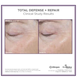 SkinMedica Total Defense + Repair SPF 34 (2.3 Oz.) -Jane Iredale || By Terry || Coola SAles Store 11289687 2094410181020096
